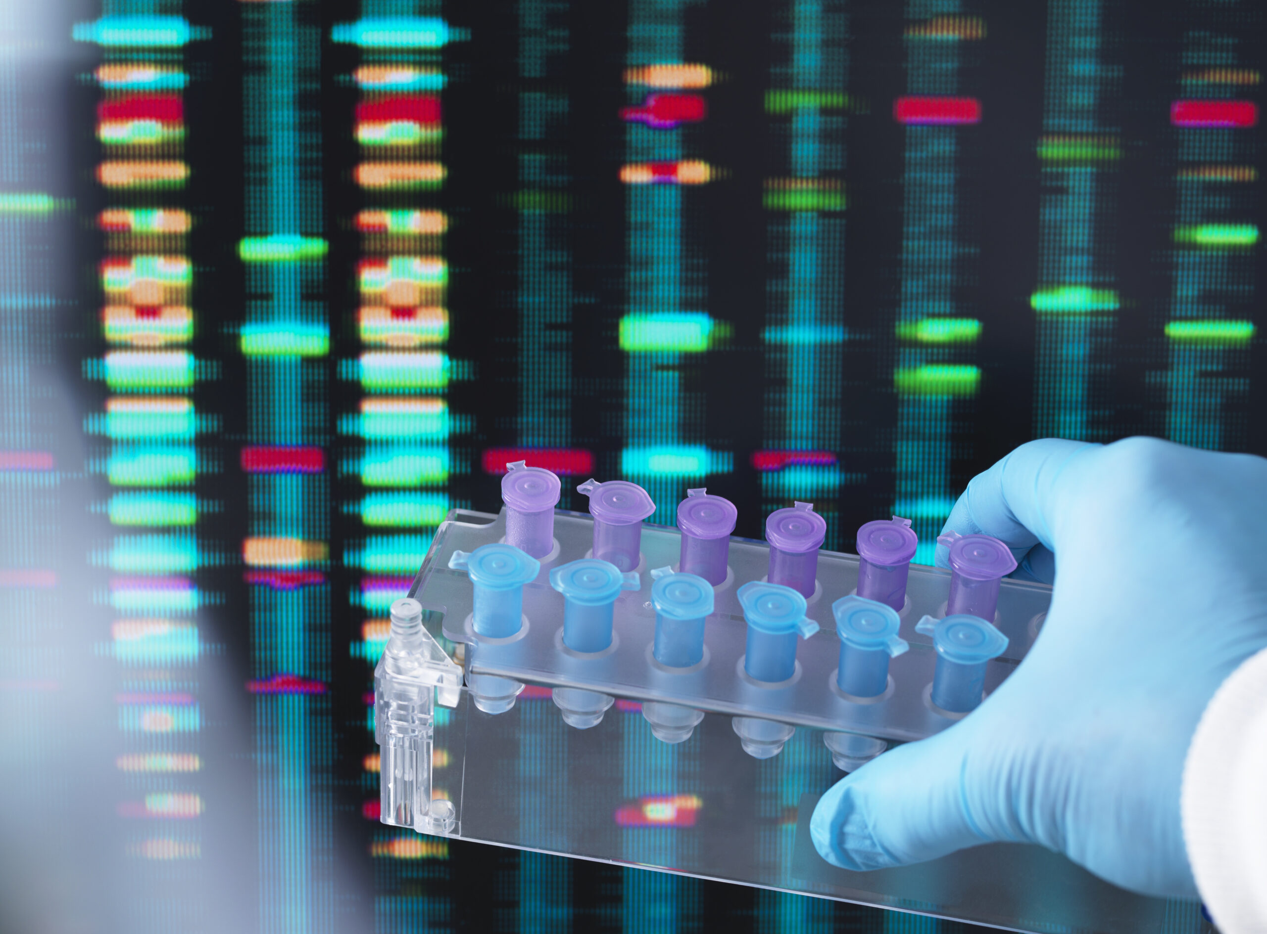 dna research, scientist holding up a tray of dna samples with results on the computer screen